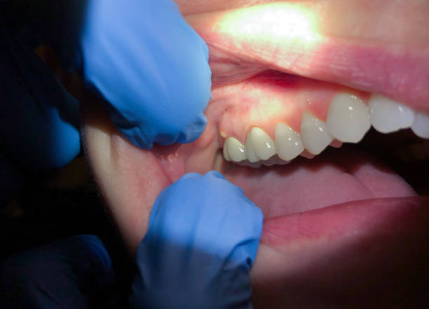 Best Emergency Dental Care for Trauma or Injury in Weatherly, PA